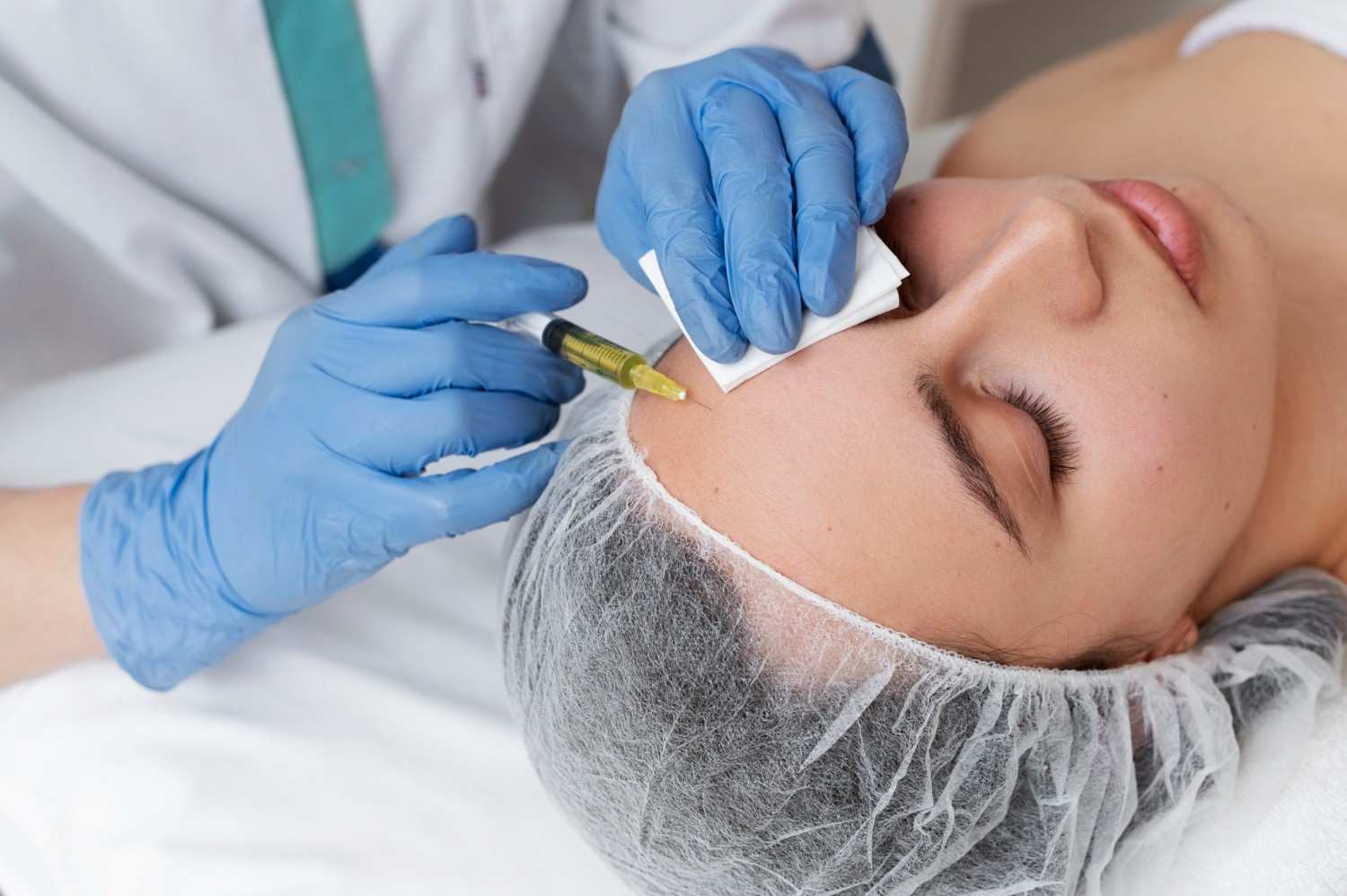 Microneedling