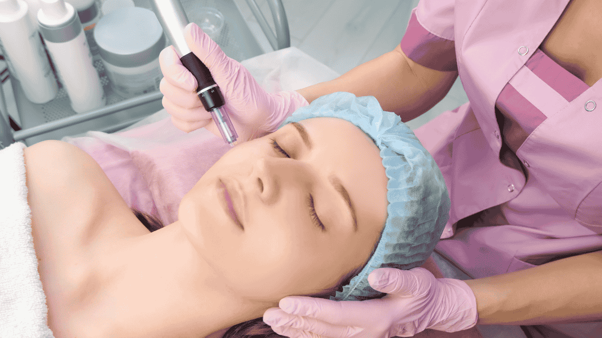 Microneedling
