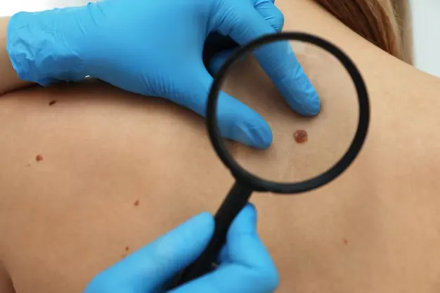 Mole removal examine