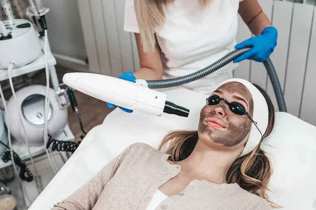 Carbon laser treatment