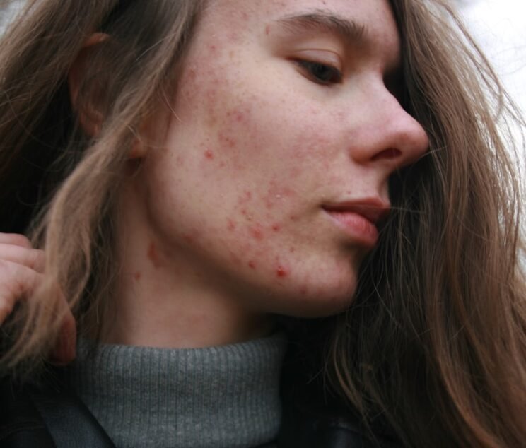 Person receiving professional dermatology treatment for skin concerns