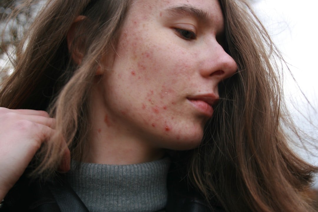 Person receiving professional dermatology treatment for skin concerns